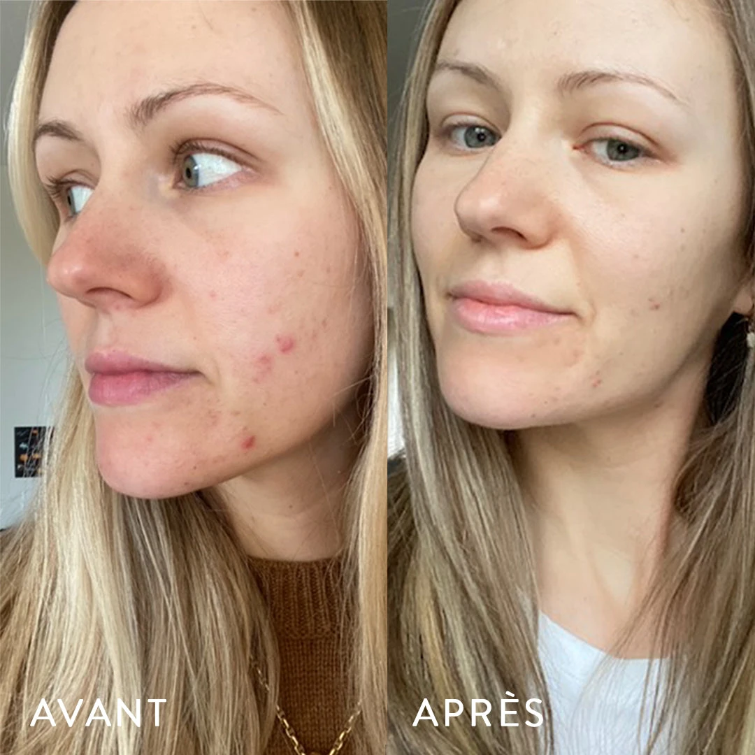 Microbiote & Peau 6 Microbiote & Peau – Image 4