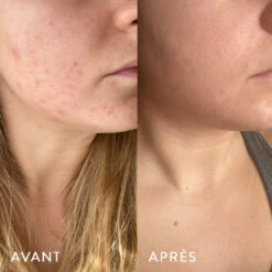 Microbiote & Peau 8 Microbiote & Peau -Magasin De Cosmétiques AVANT APRES LAURA .1.3jpg